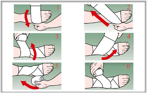 Hướng dẫn sử dụng băng keo thể thao 